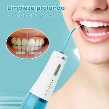 Irrigador Dental Portátil F18 – Limpieza Profunda y 4 Modos